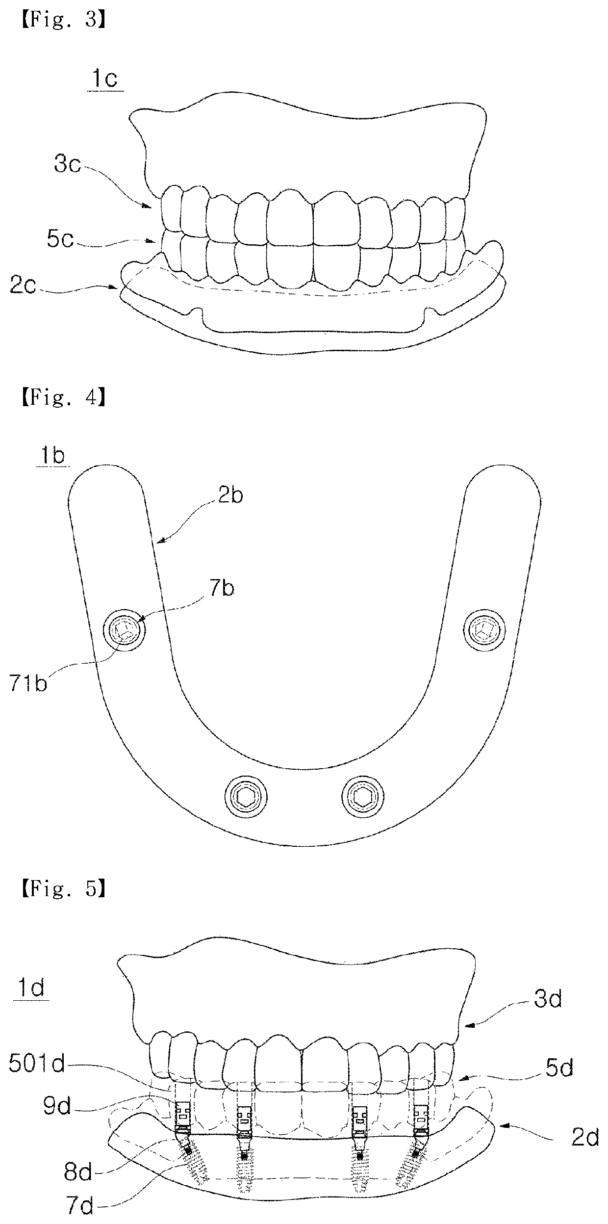 Digital denture manufacturing method and manufacturing system, and denture hole guider applied thereto and manufacturing method thereof