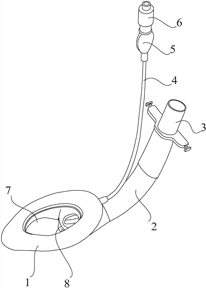 A novel laryngeal mask with multiple trachea channels