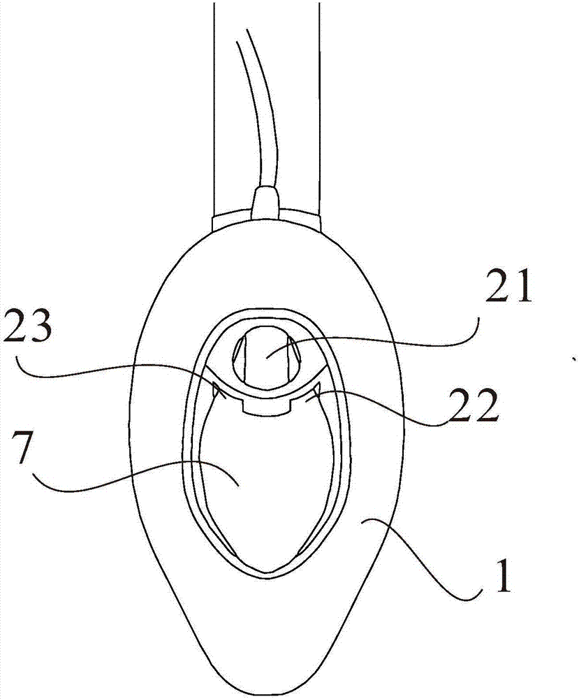 A novel laryngeal mask with multiple trachea channels