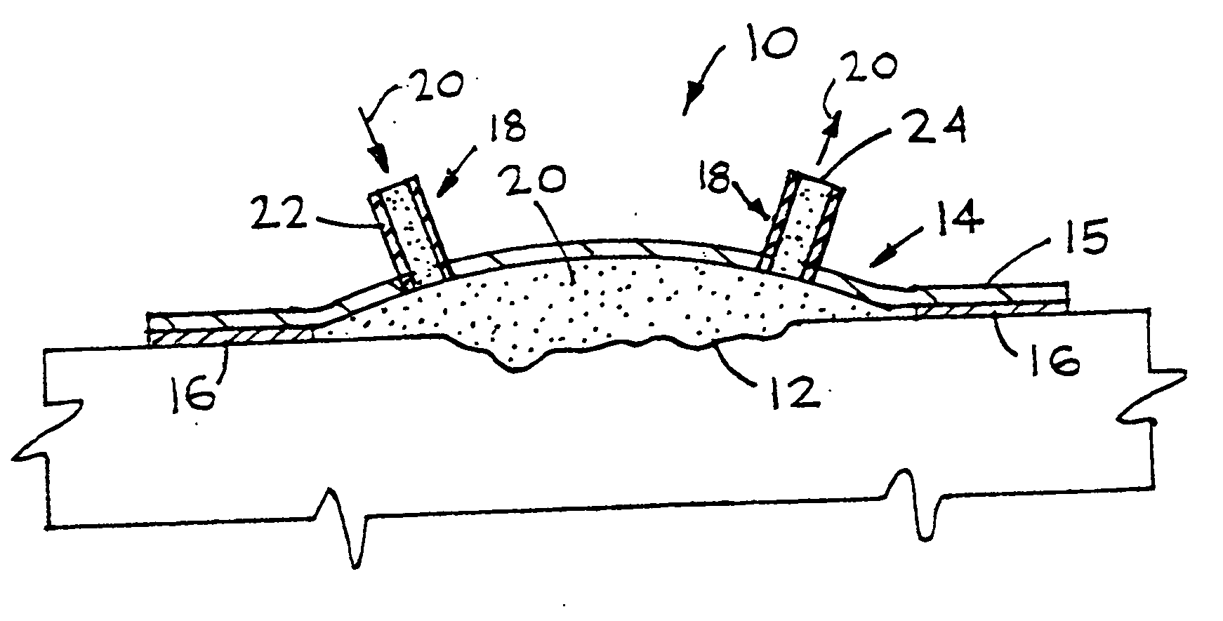 Device for treating and promoting healing of damaged body tissue