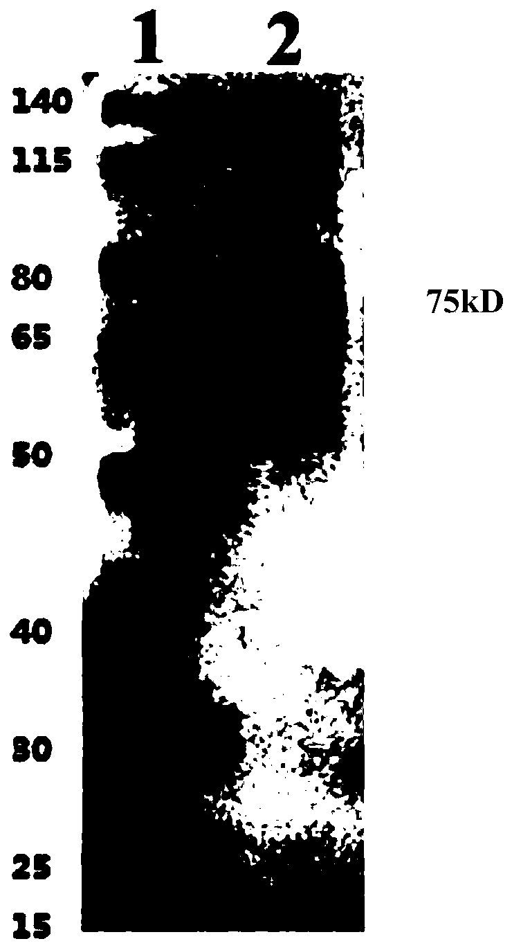 Monoclonal antibody resisting Tilapia immunoglobulin IgM, cell strain of monoclonal antibody and application of monoclonal antibody