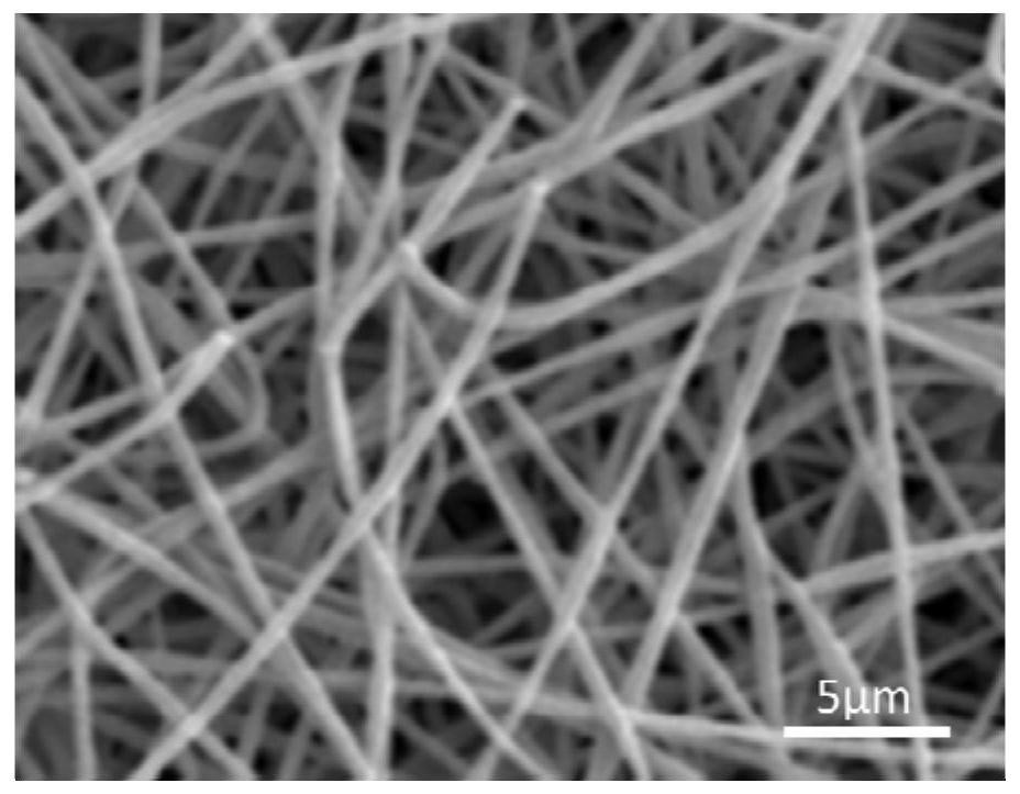 Implant for preventing bone cement leakage, preparation method and application, complete set of products for preventing bone cement leakage and using method