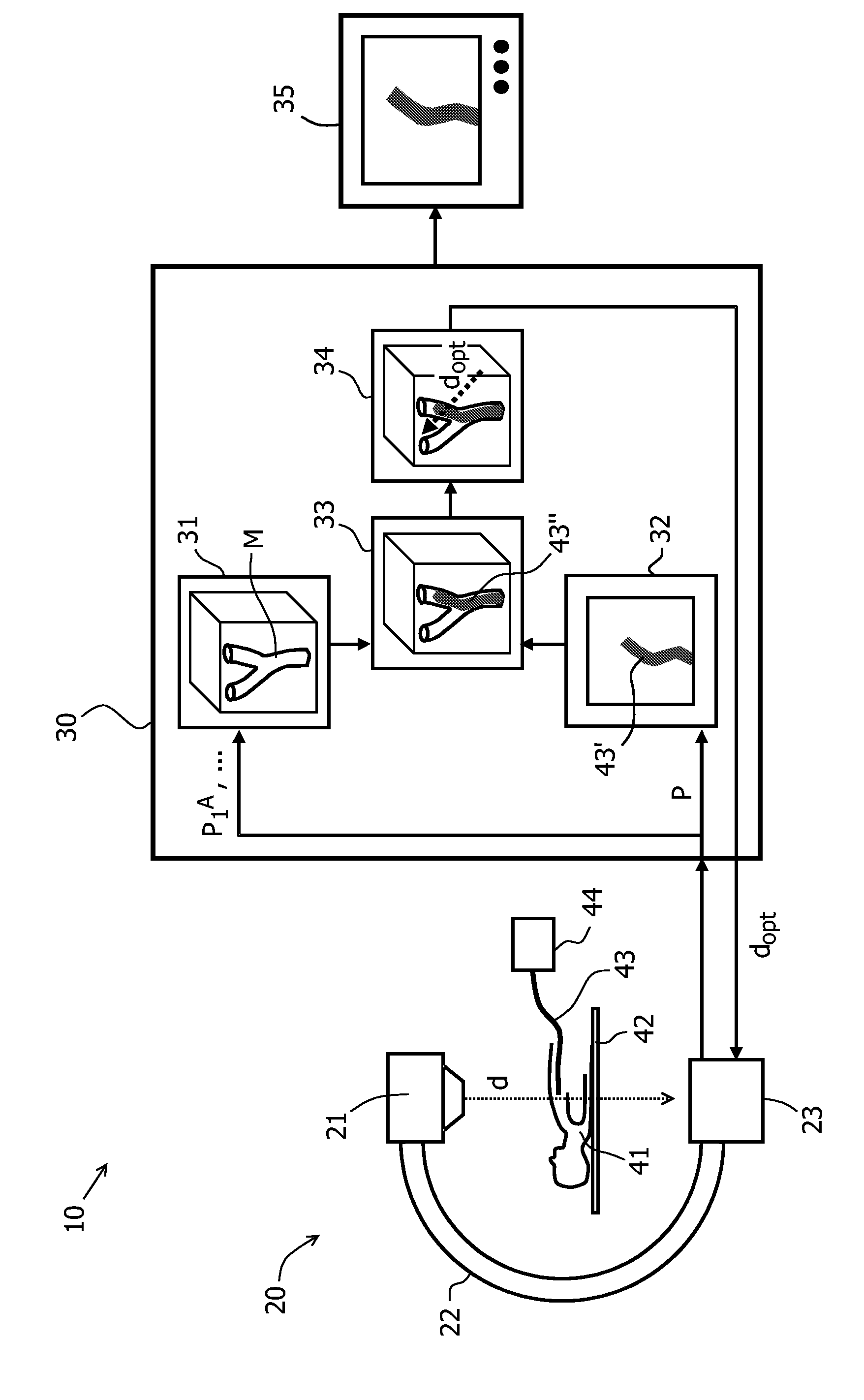 Method and apparatus for the observation of a catheter within a vessel system