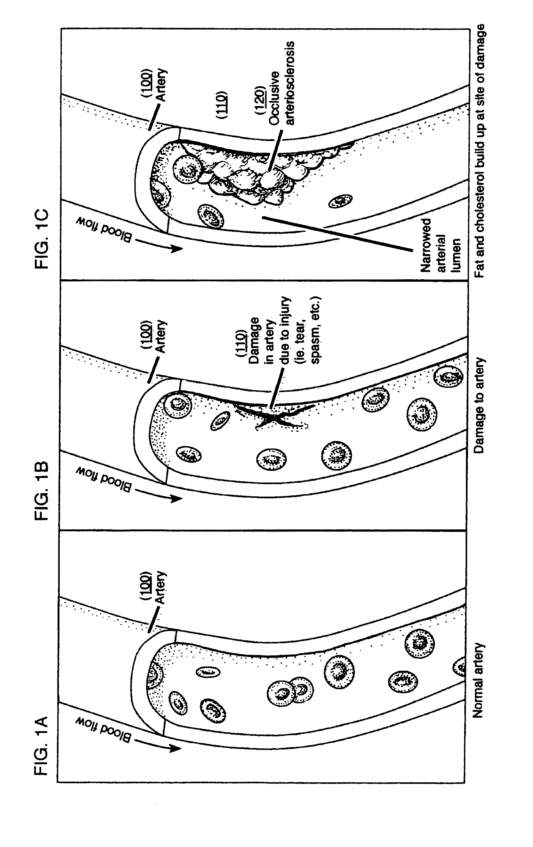 Methods and compositions to treat myocardial conditions