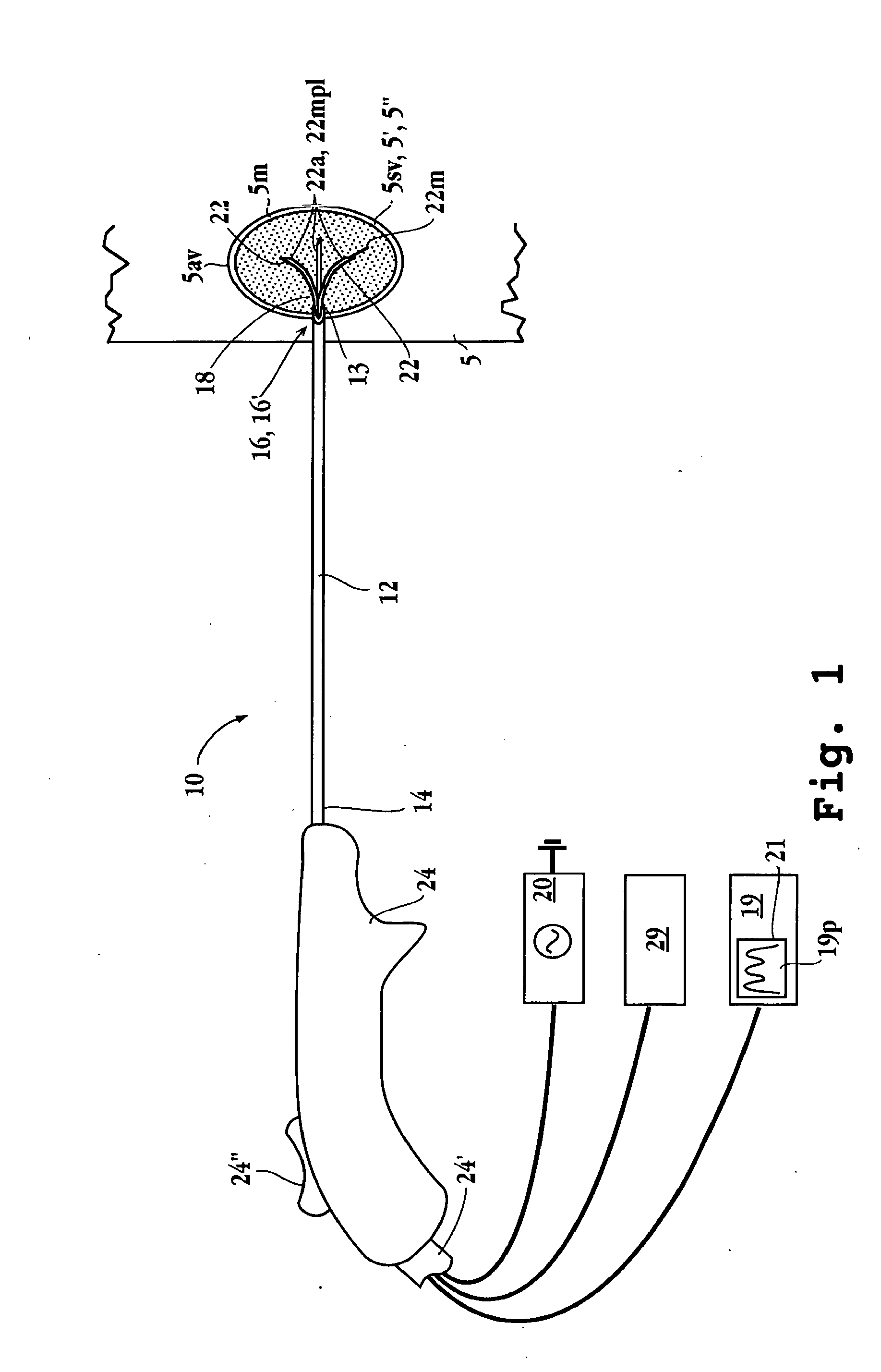 Tissue ablation apparatus and method