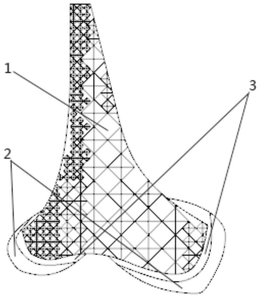 A method for manufacturing a multi-material porous distal femur implant