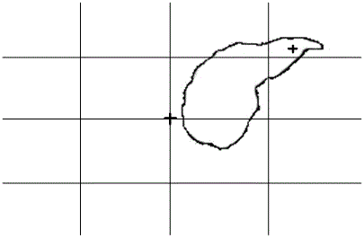 Cursor moving method and device for medical display and medical equipment