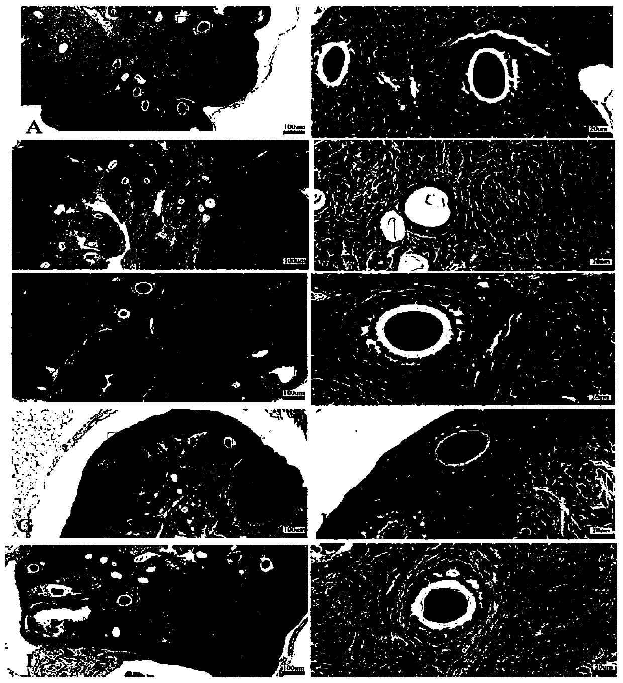 Application of Chinese and western medicine compound components to treatment of hepatolenticular degeneration with reproductive system damage diseases