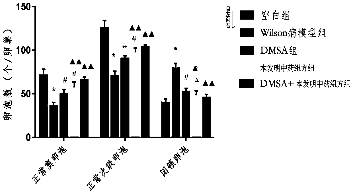 Application of Chinese and western medicine compound components to treatment of hepatolenticular degeneration with reproductive system damage diseases