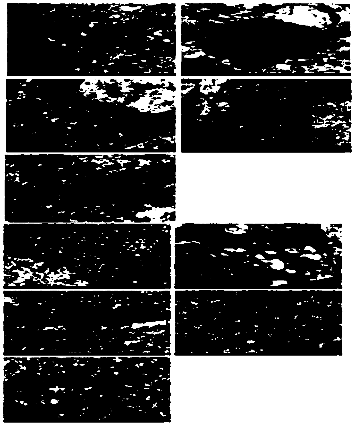 Application of Chinese and western medicine compound components to treatment of hepatolenticular degeneration with reproductive system damage diseases