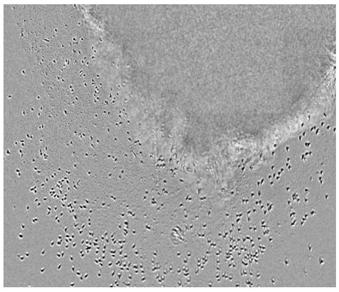 Method applicable to isolation and introduction of infiltrating T lymphocytes in malignant solid tumors