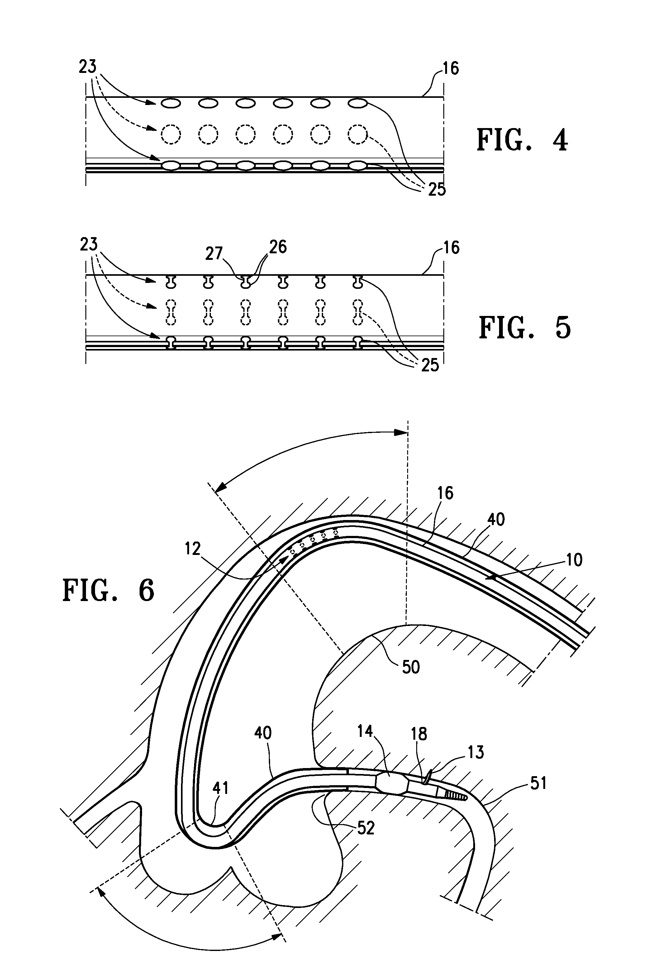 Catheter configured for incremental rotation