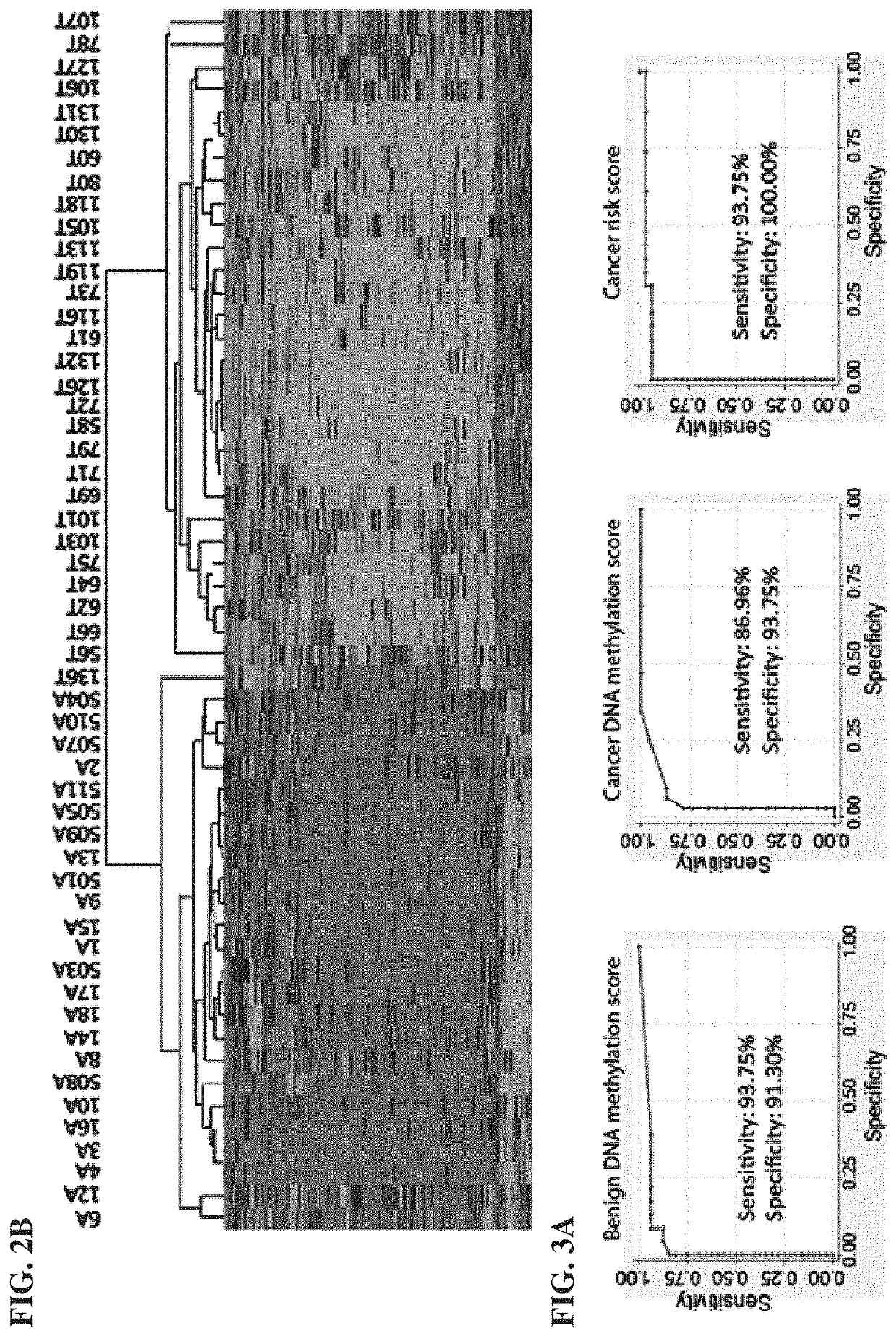 Methods, treatment, and compositions for characterizing thyroid nodule