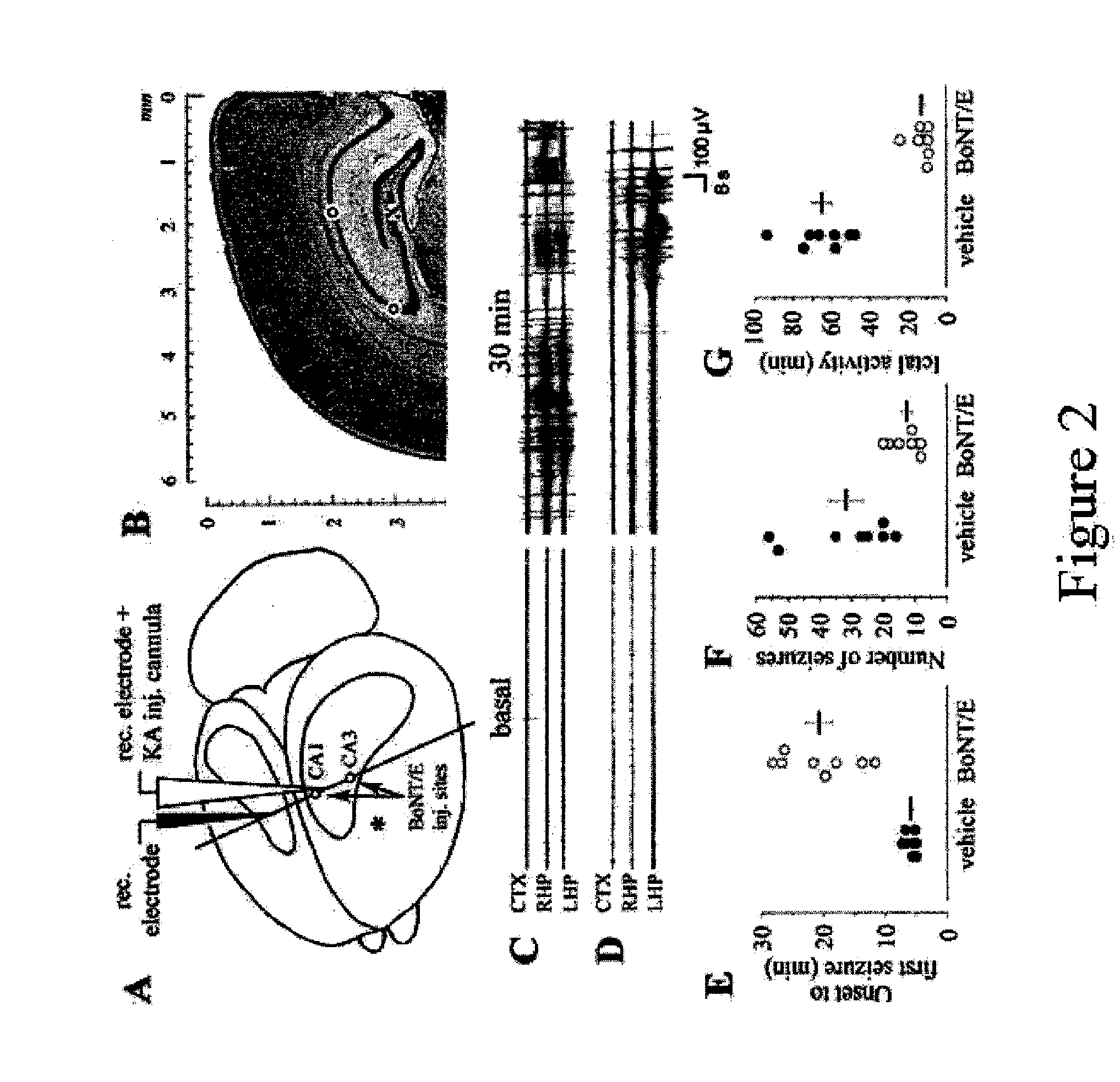 Method for the Mapping of the Epileptogenic Focus in the Pre-Surgical Evaluation of Patients with Intractable Epilepsy