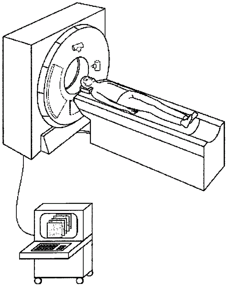 CT imaging system