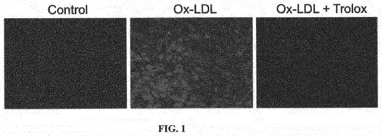 Compounds and compositions for inhibiting retinal pigment epithelium degeneration and methods using the same