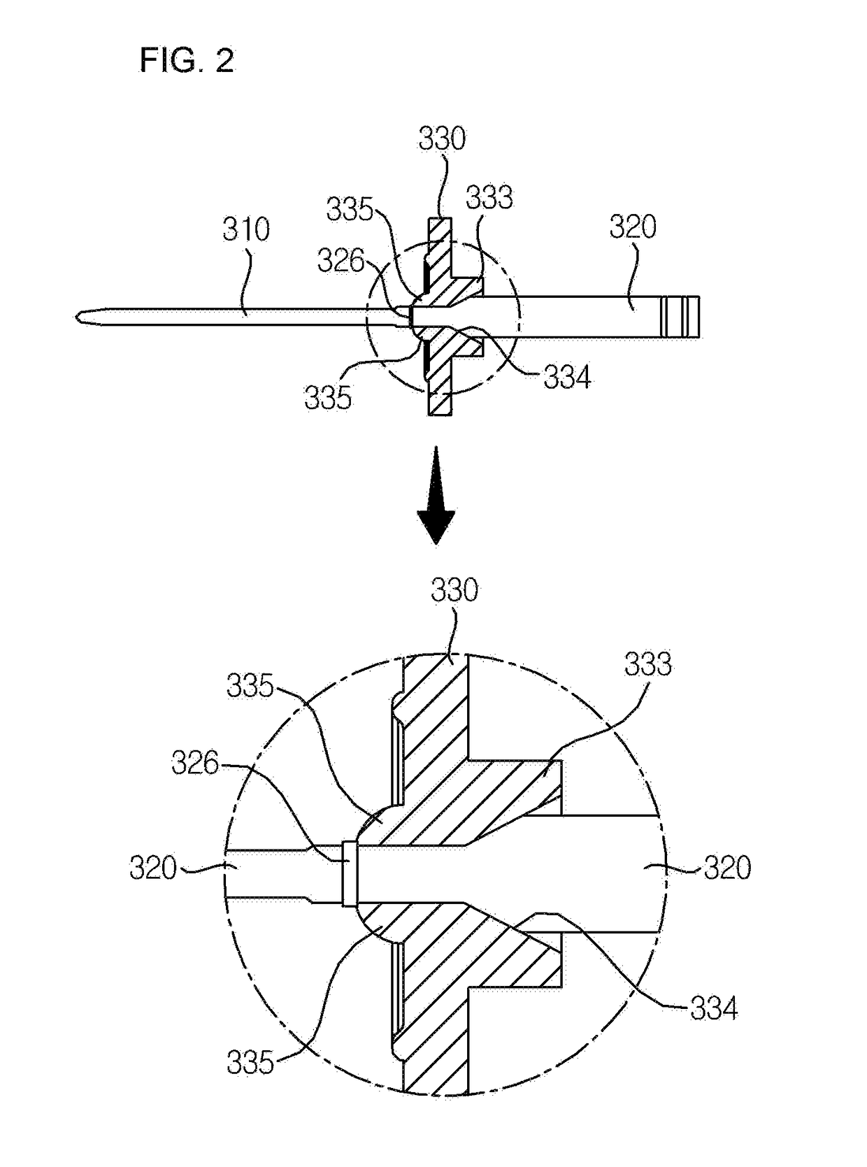 Cartridge for treating dental root and method for manufacturing needle for treating dental root