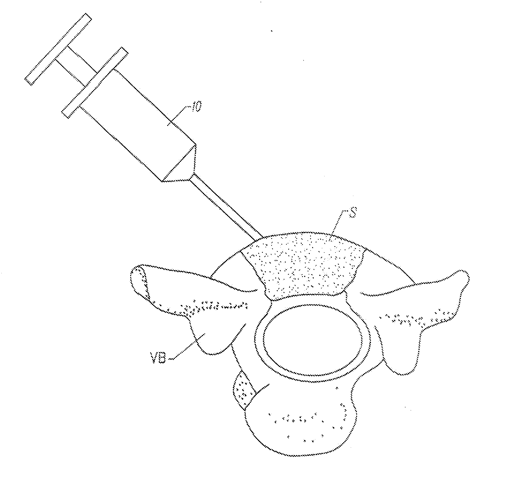 Fragmented polymeric compositions and methods for their use