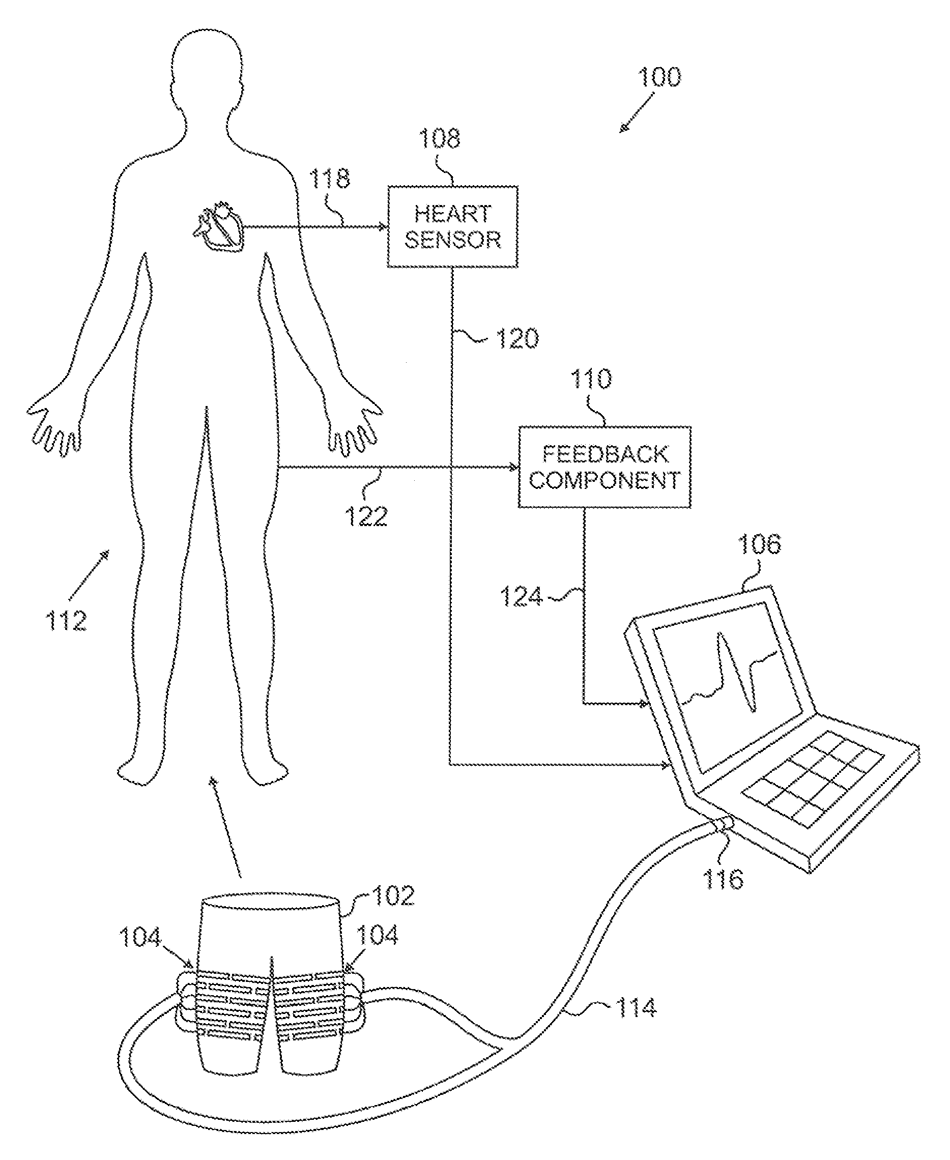 External counterpulsation device using electroactive polymer actuators