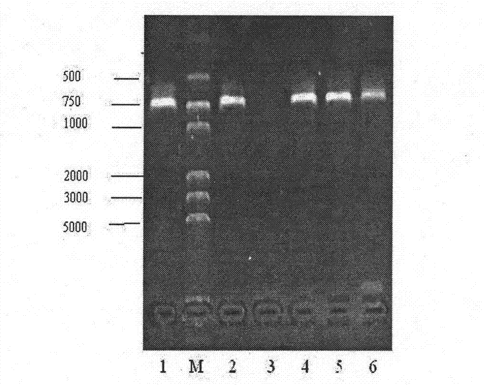 Swine Streptococcosis trivalent inactivated vaccine and preparation method thereof