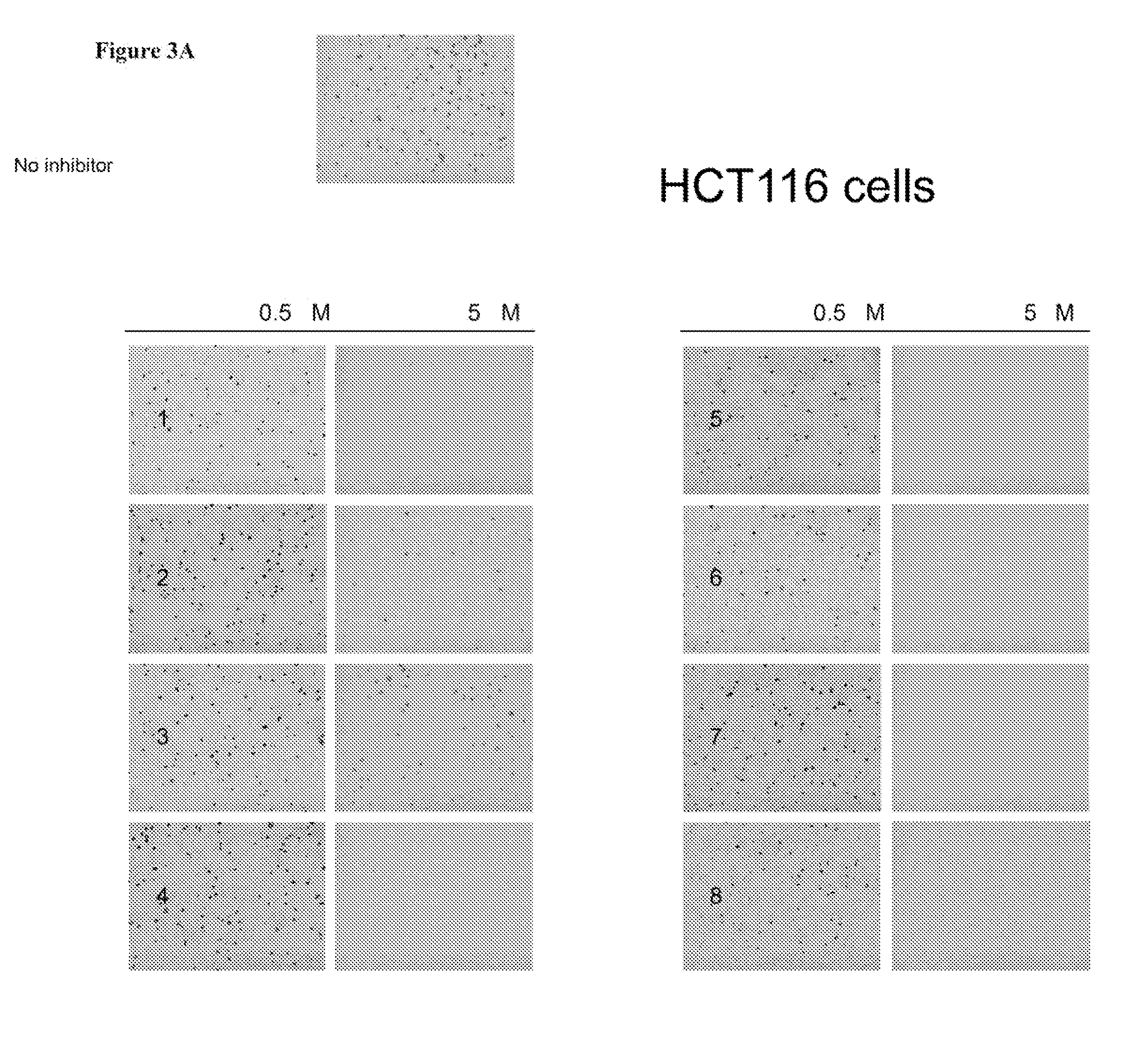 Aurora kinase inhibitors