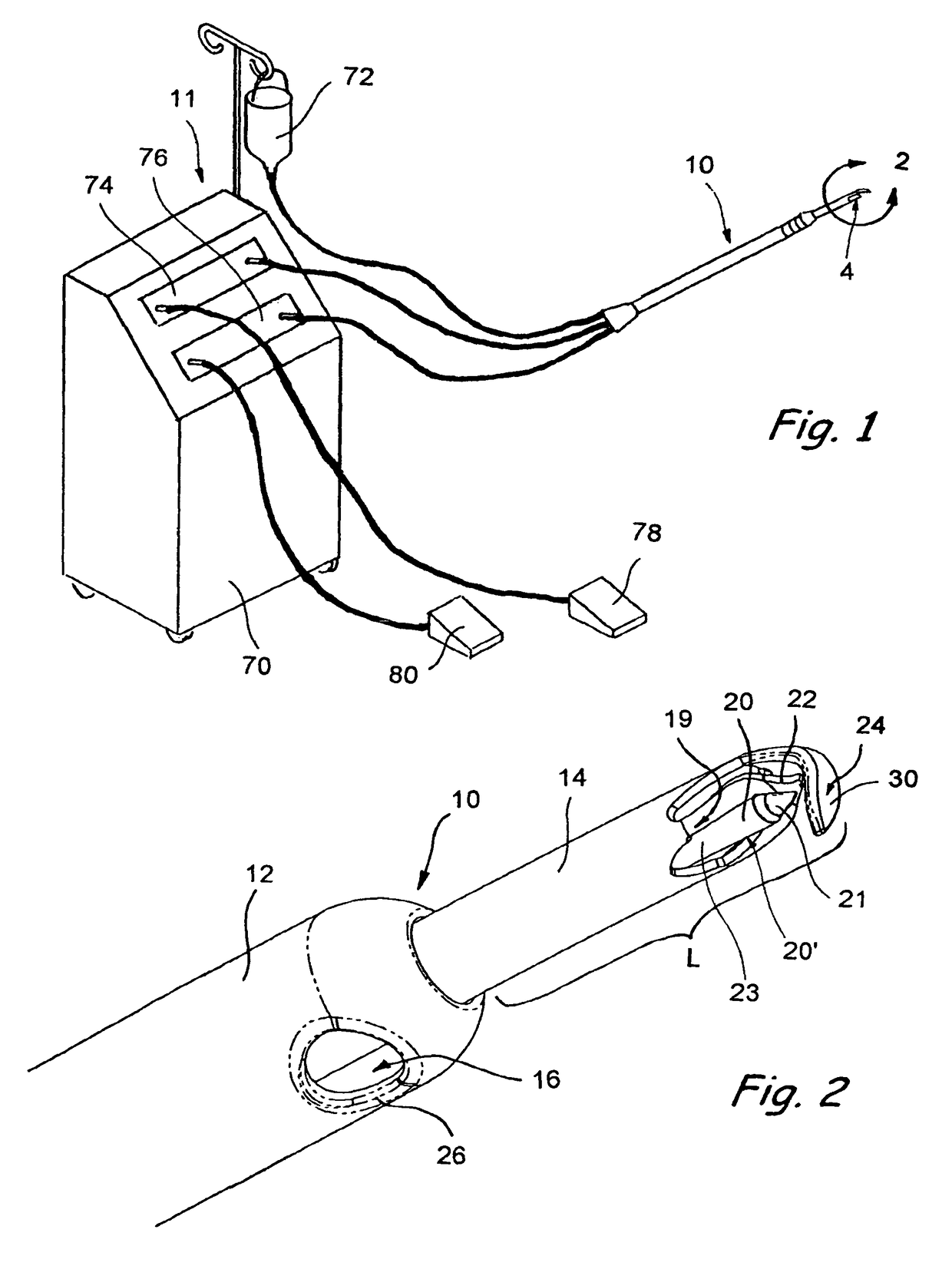 Devices useable for treatment of glaucoma and other surgical procedures