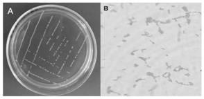Lactococcus garvieae LGHK2 and application thereof