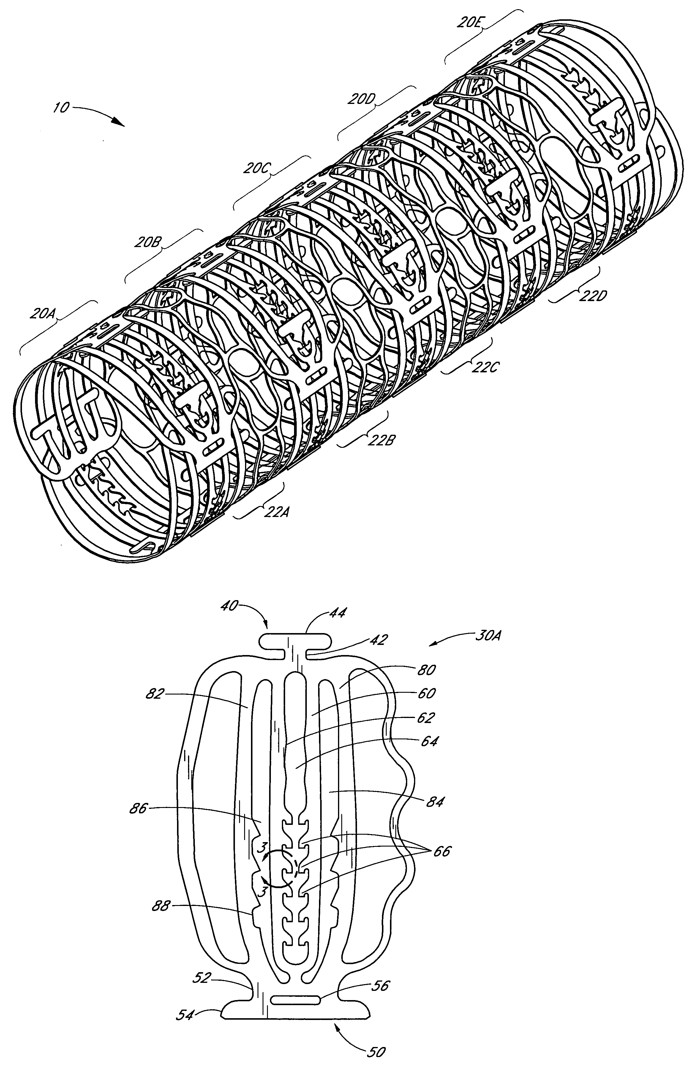 Balloon expandable crush-recoverable stent device