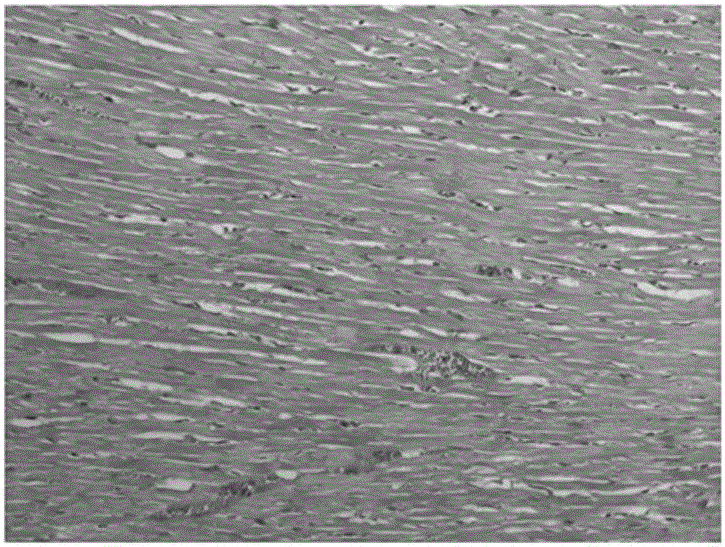 Uses of myocarditis protein marker