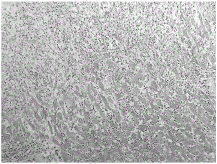 Uses of myocarditis protein marker