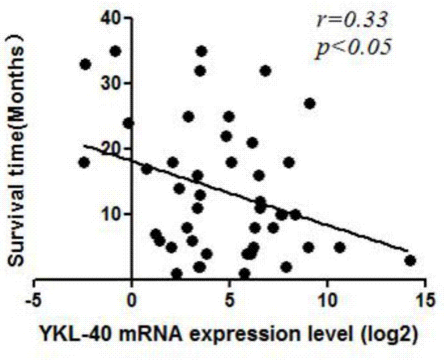 Application of YKL-40 as glioblastoma biomarker