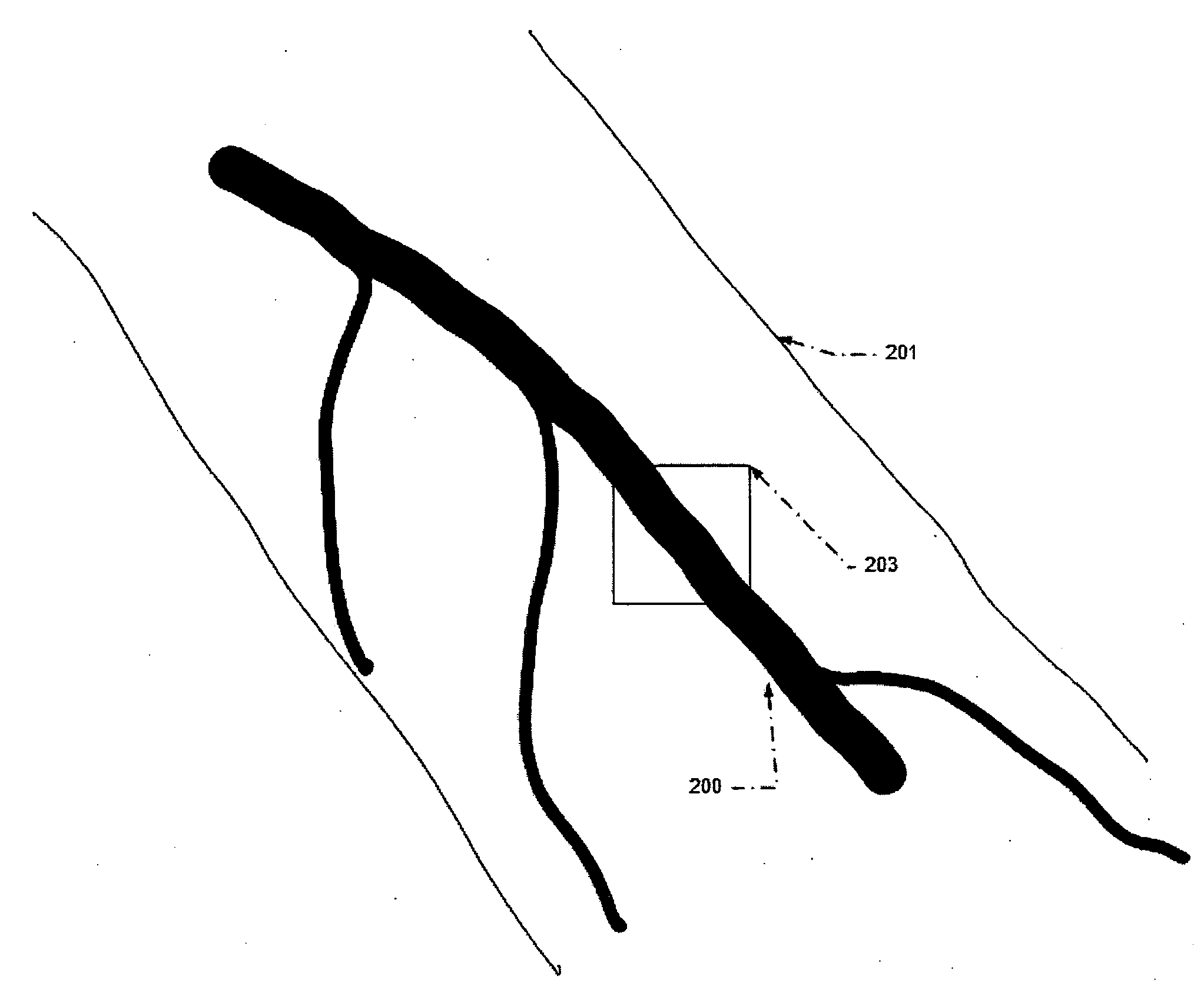 Automatic alignment of a contrast enhancement system