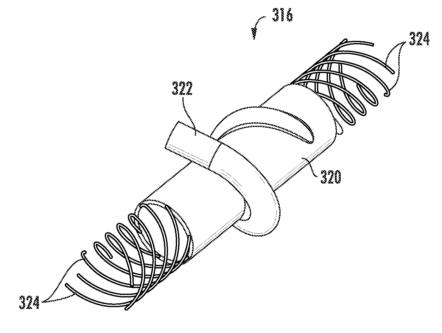 Method and apparatus for bypass graft