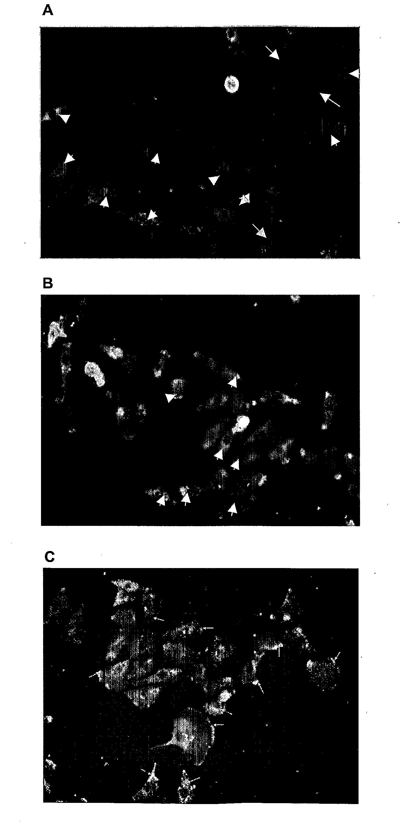 Inhibitors of protein kinase c isoforms and uses thereof