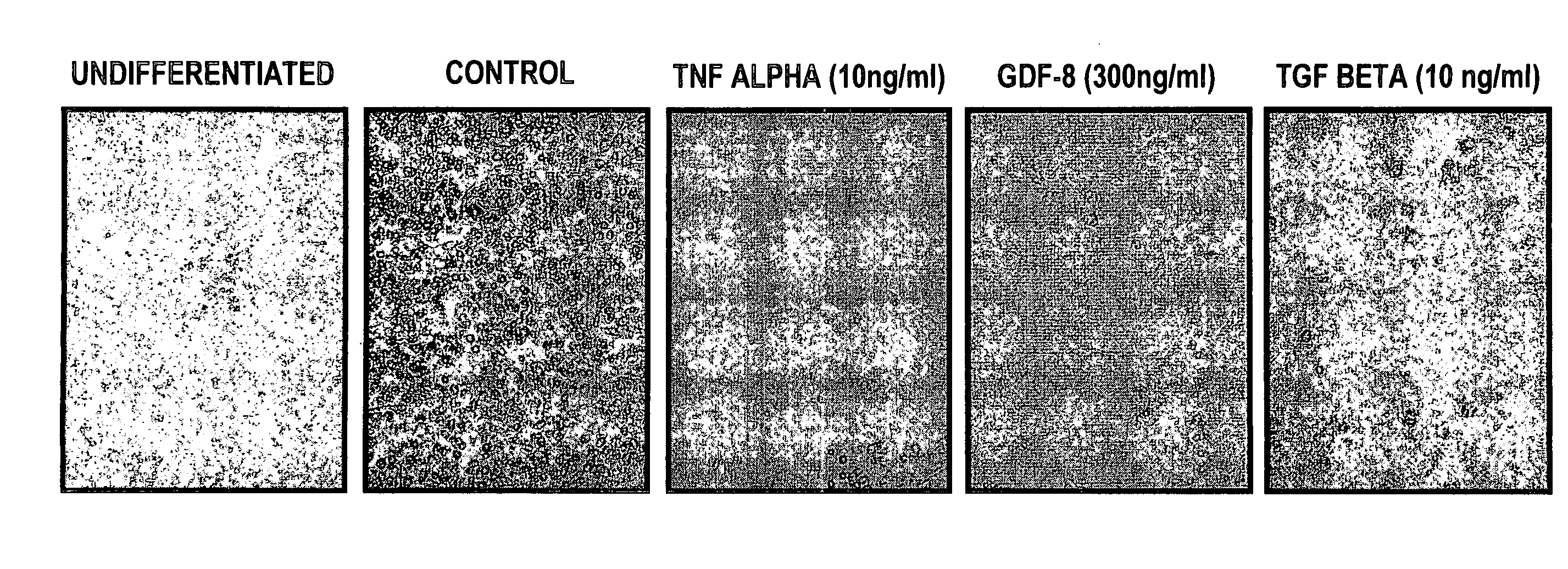 Methods for treating diabetes