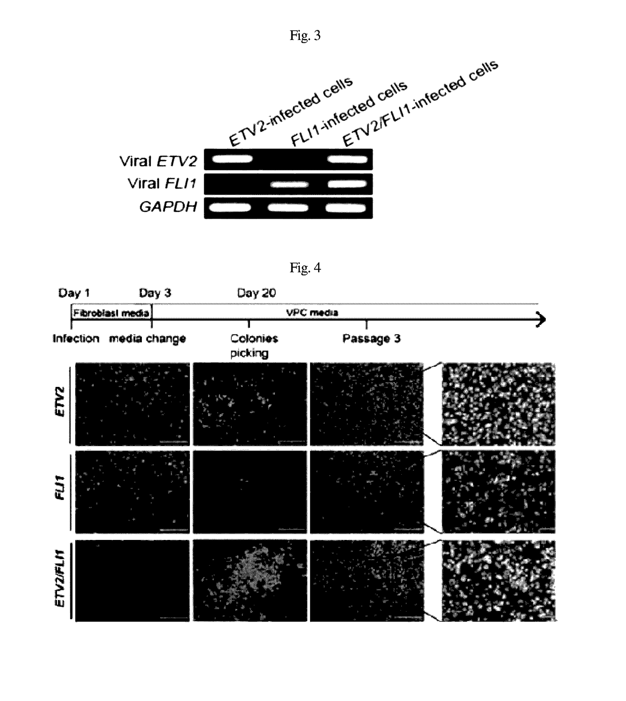 Composition for inducing direct transdifferentiation of somatic cell into vascular progenitor cell, and use thereof