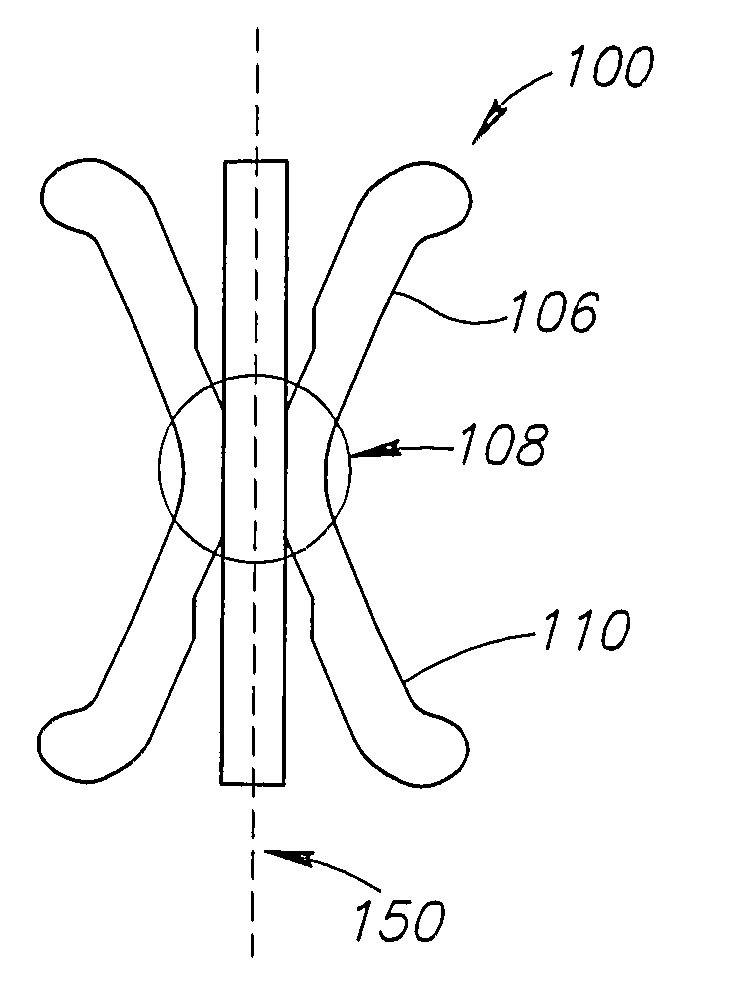 Apparatus for the Prevention of Urinary Incontinence in Females