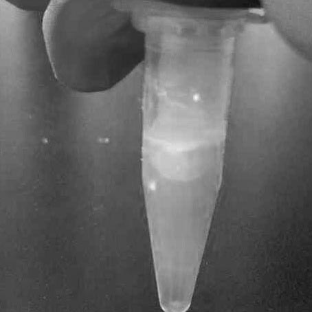 A kind of apolipoprotein e detection kit