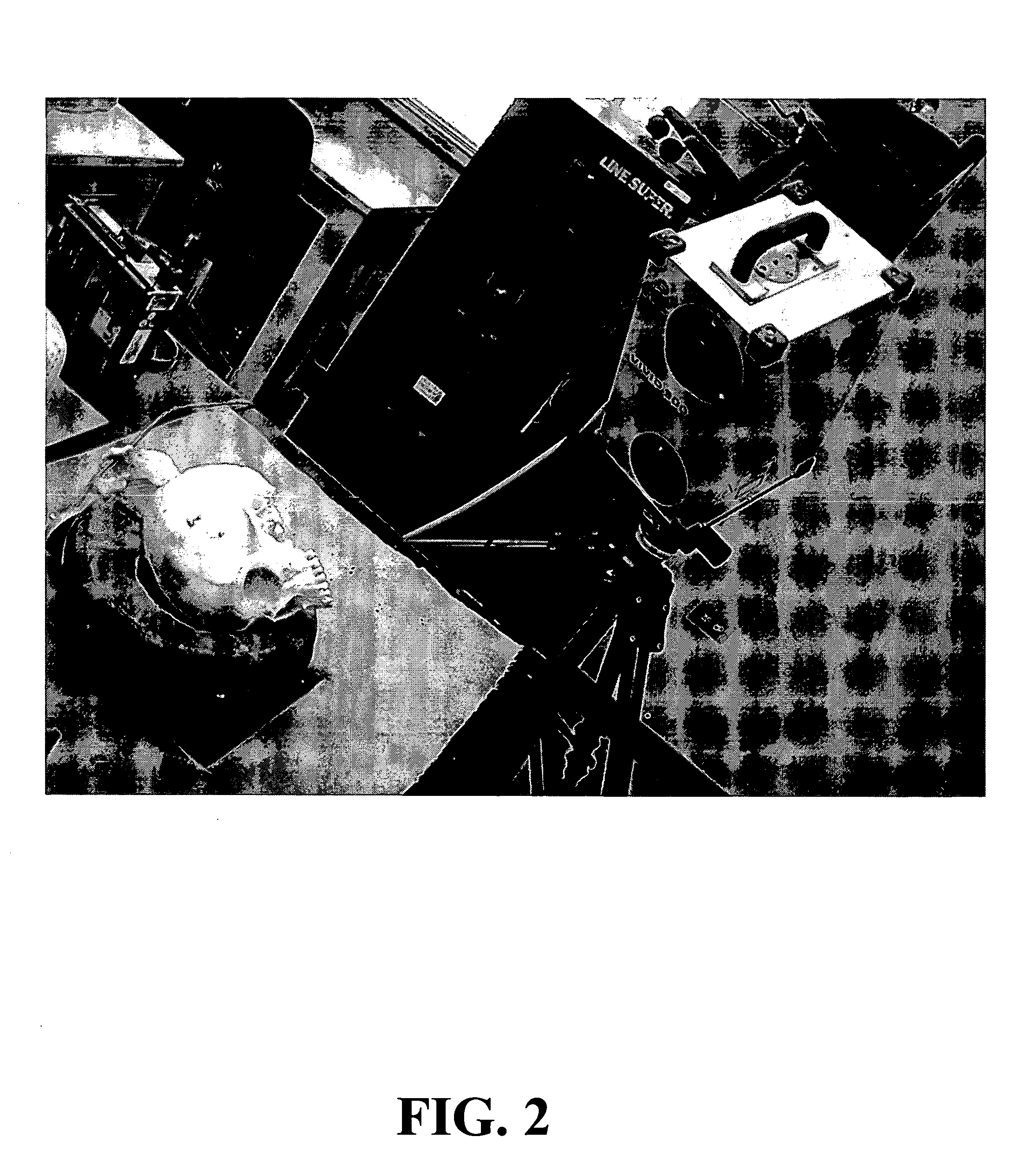 Method and system for morphometric analysis of human dental occlusal function and uses thereof