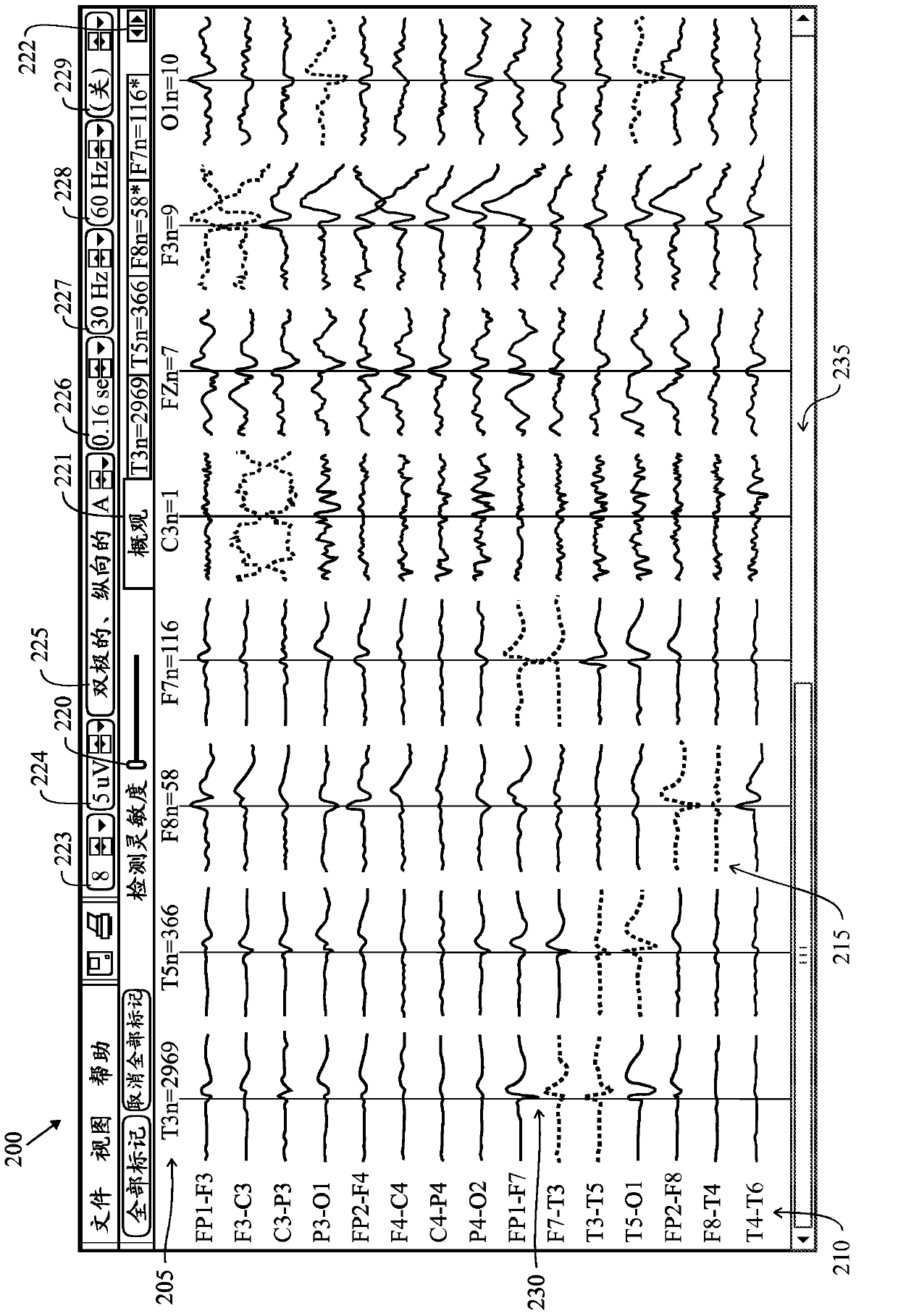 Method and system for analyzing an eeg recording