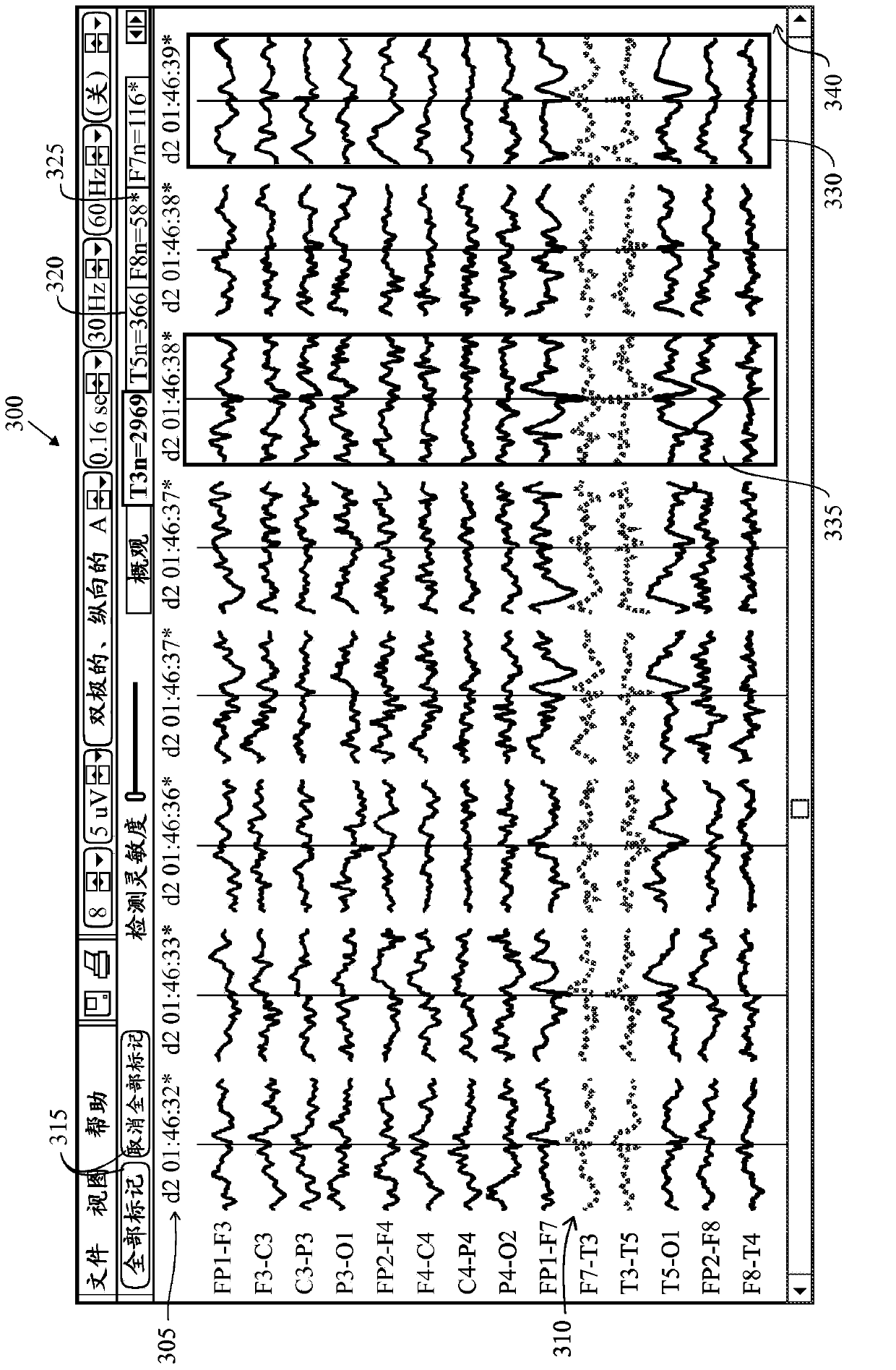 Method and system for analyzing an eeg recording