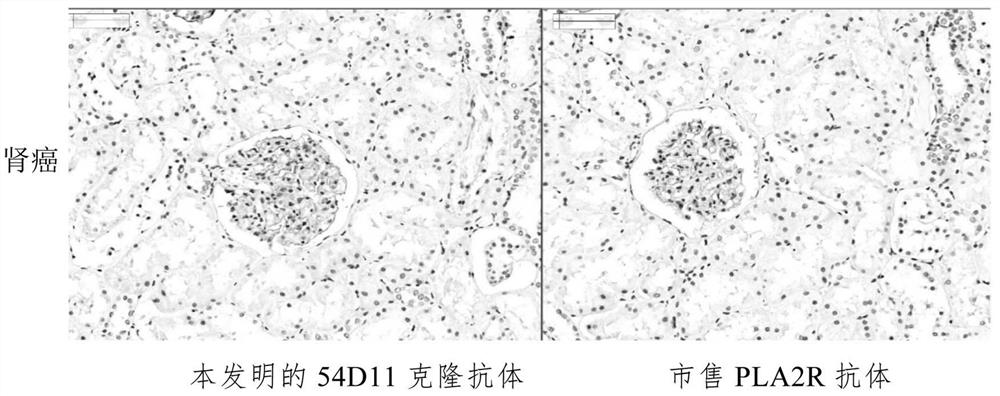 A kind of anti-pla2r recombinant rabbit monoclonal antibody and its application