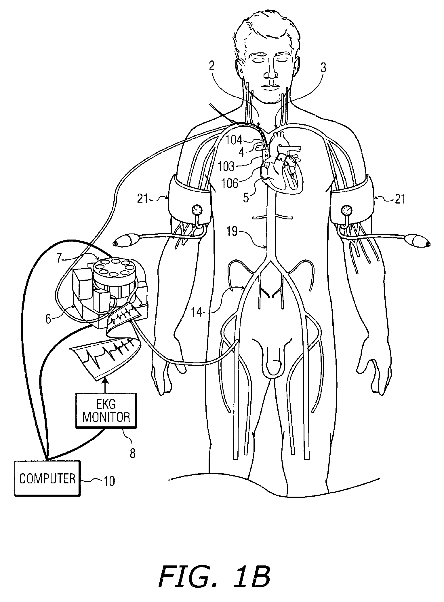System, methods and apparatus for cerebral protection
