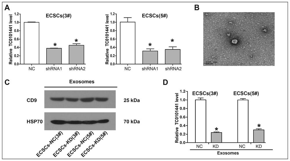 Use of circulating exosomal long non-coding RNA-tc0101441 as a marker for the diagnosis of endometriosis