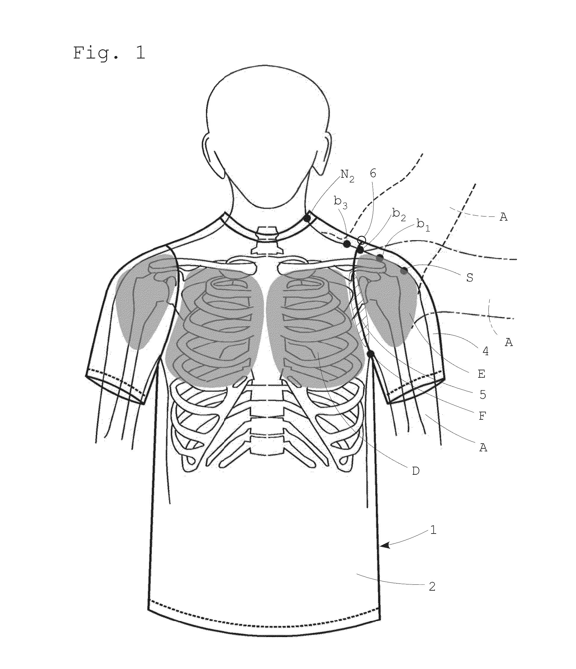 Upper garment