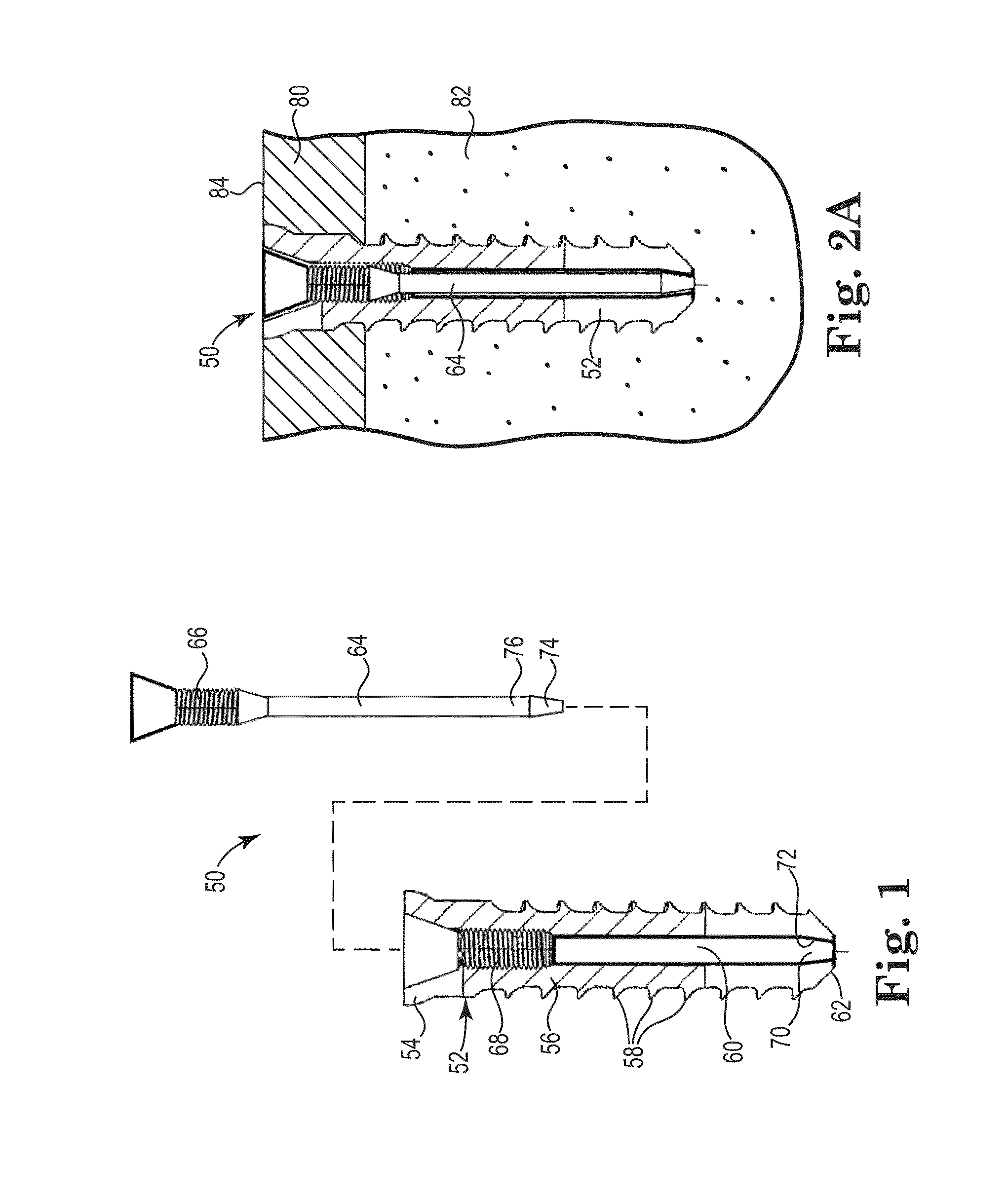 Fixation system for orthopedic devices