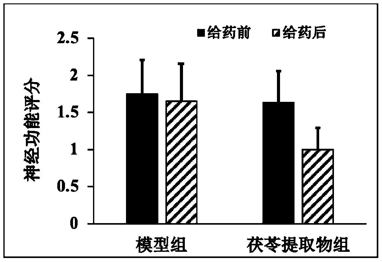 Preparation method of poria cocos extract for treatment of cerebral apoplexy and application