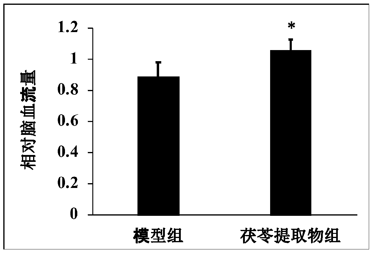 Preparation method of poria cocos extract for treatment of cerebral apoplexy and application
