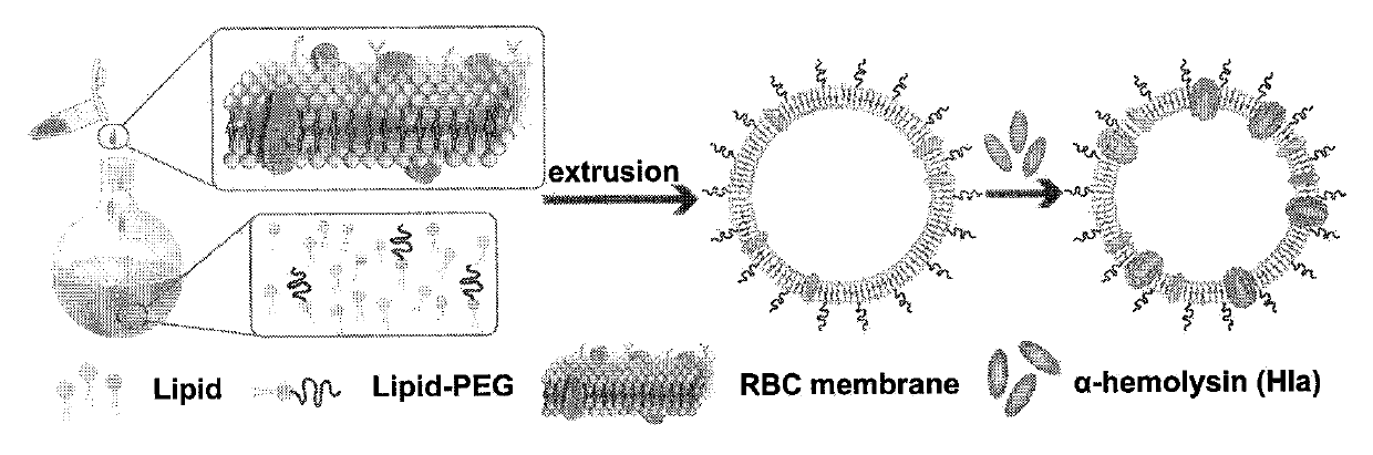 Nano medicine system with bacterium pore-forming toxin adsorption capability and application of nano medicine system