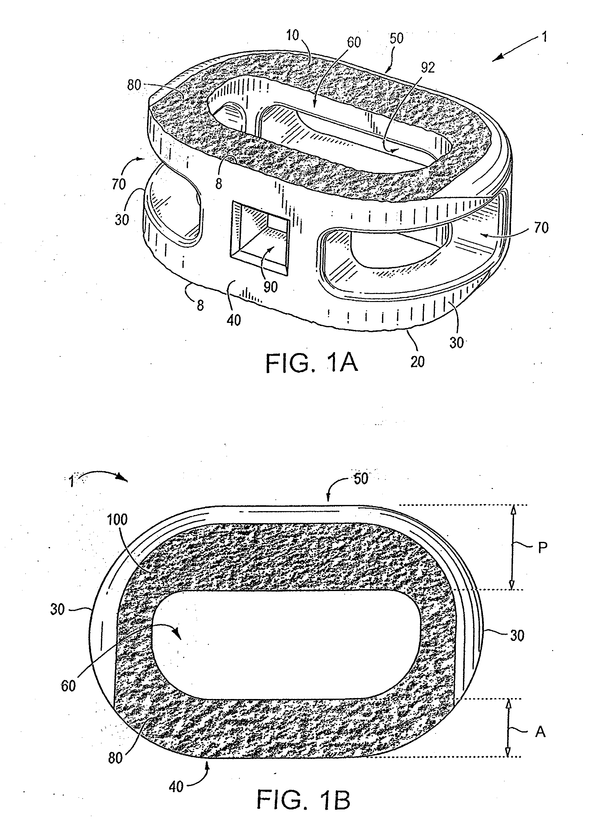 Spinal implant having variable ratios of the integration surface area to the axial passage area